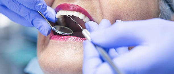 Best Emergency Wisdom Teeth Removal in Daleville, IN